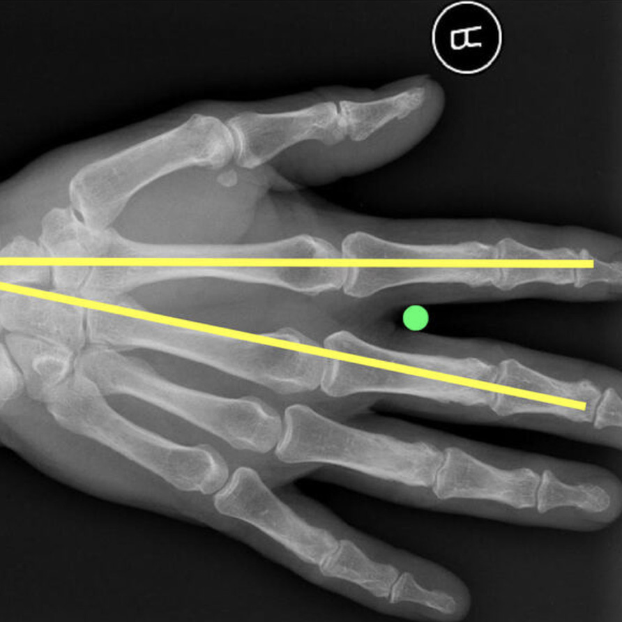 hand-x-ray.jpg
